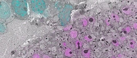 Correlativ light- and electron-microscopic image of mushroom body calyx tissue