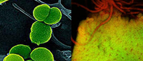 Bild und Link: Mikrobiologie
