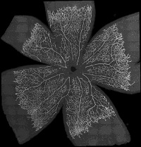 Mouse retina to make angiogensis defects visible. 