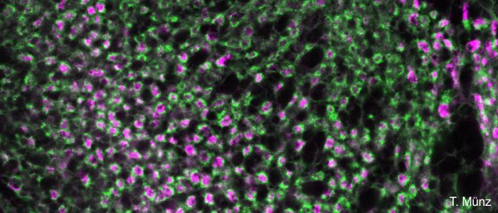 Fluoreszenzbild zeigt Mikroglomeruli Komplexsynapsen im Pilzkörper Neuropil der Honigbiene
