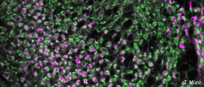 Fluorescence image showing microglomeruli complex synapses in the honeybee brain