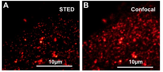 StREM1.3-labeled nanodomains in Arabidopsis thaliana epidermal cells.
