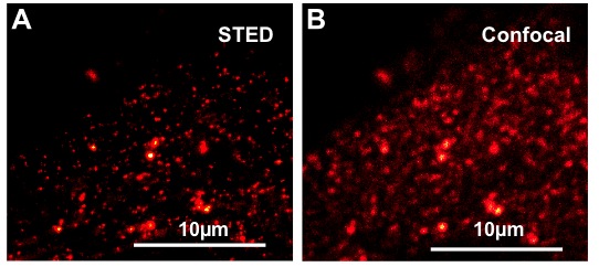 Visualisierung von Membrandomänen in Arabidopsis thaliana Epidermiszellen mit Hilfe des Markerproteins StREM1.3.