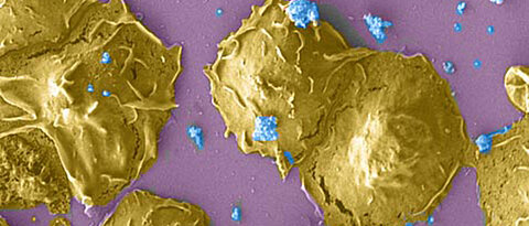 Polymorphic nuclear leukocytes infected with Chlamydia (blue). (Photo: Karthika Rajeeve)