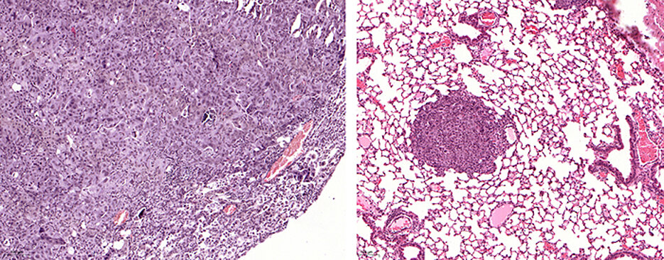 A lung tumor that expresses USP28 (left). On the right, however, tumors are shown in which USP28 has been "cut out" using the gene editing tool CRISPR/Cas9 – they are significantly smaller. The size bar is located on the left edge of the picture.