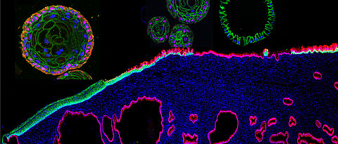 Image of human cervix tissue and organoids derived from ectocervical stratified squamous (green) and endocervical columnar (red) epithelial stem cells.