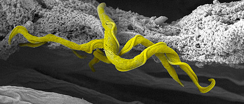Sie sind klein, anpassungsfähig und gefährlich: Trypanosomen - hier im Darm der Tsetsefliege zu sehen.