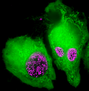 ImageJ=1.49u
unit=micron
