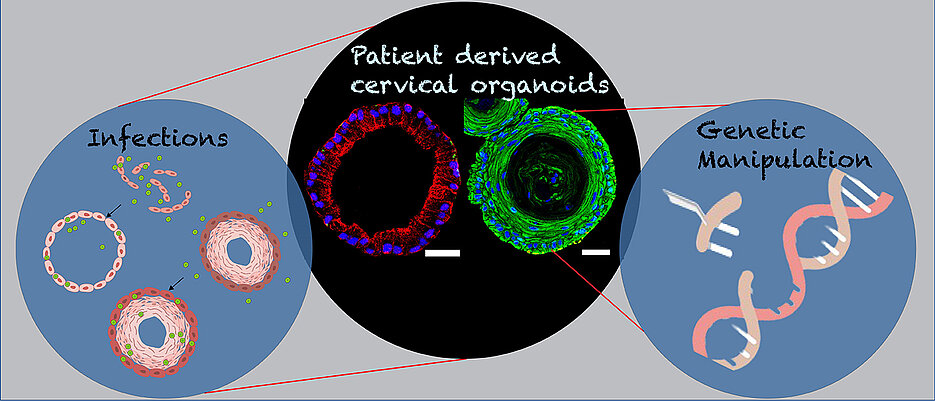 Das Bild zeigt von Patientinnen gewonnene endozervikale säulenförmige (rot) und ektozervikale geschichtete Plattenepithelorganoide (grün) des weiblichen Fortpflanzungstrakts. Das Diagramm verdeutlicht deren Rolle für genetische Manipulationen und bei Infektionen. 