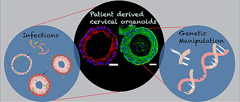 Image of patient-derived endocervical columnar (red) ectocervical stratified squamous organoids (Green) of female reproductive tract, and diagram depicting their genetic manipulation and infections. 