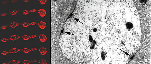 Mikroskopische Bilder von der Synapse