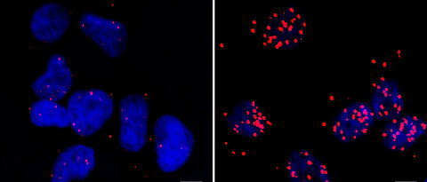 Zellen eines Neuroblastoms: Die roten Punkte markieren Stellen, an denen das BRCA1-Protein in engem Kontakt mit der RNA-Polymerase II vorkommt. Das ist nur dann der Fall, wenn auch das Protein MYCN vorliegt (rechtes Bild).