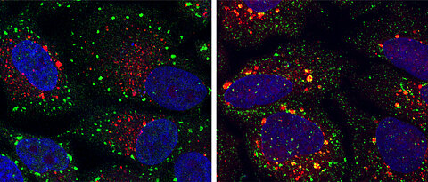 Microscopic colour image showing cells with normal (green dots) and abnormal (yellow dots) stress granules. (Photo: Buchberger team)