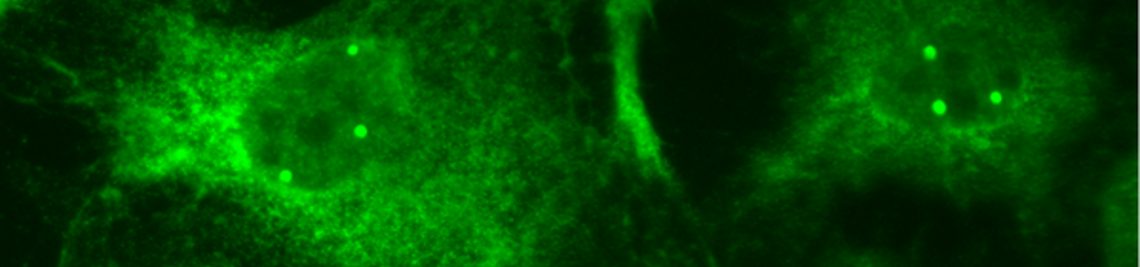 Immunofluorescence of the SMN protein