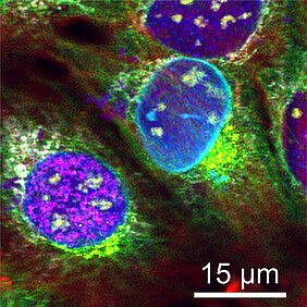 Einmalig: Neun verschiedene Zellstrukturen wurden in einem Aufwasch fluoreszenzmarkiert und damit mikroskopisch unterscheidbar gemacht. (Bild: Thomas Niehörster)
