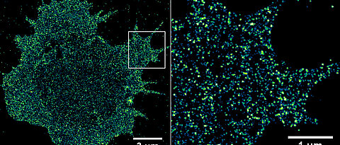 Immunrezeptoren auf einer Krebszelle. Mit Hilfe der hochauflösenden Fluoreszenzmikroskopie ist es möglich, Rezeptoren in der Zellmembran mit Einzelmolekül-Sensitivität zu visualisieren und zu quantifizieren. (Bild: Sebastian Letschert)