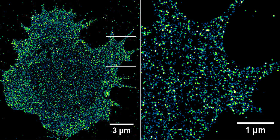 Immunrezeptoren auf einer Krebszelle. Mit Hilfe der hochauflösenden Fluoreszenzmikroskopie ist es möglich, Rezeptoren in der Zellmembran mit Einzelmolekül-Sensitivität zu visualisieren und zu quantifizieren. (Bild: Sebastian Letschert)