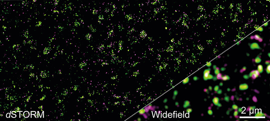 The distribution of the glutamate receptor mGluR4 and other proteins in the presynaptic membrane Left a high-resolution dSTORM image. On the right, the result obtained with conventional fluorescence microscopy – molecular details are not visible here. 