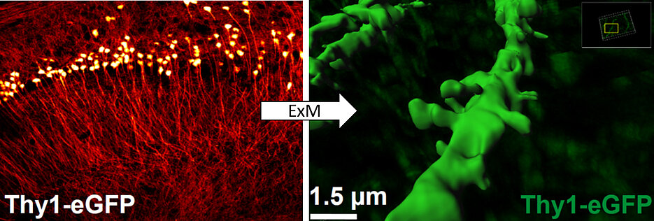 Super-resolution images made in Würzburg: Expansion microscopy ExM can be used to precisely depict fine structures of the brain whose shape changes during learning and memory processes. Pyramid cells from the hippocampus of the mouse line Thy1-eGFP can be seen.