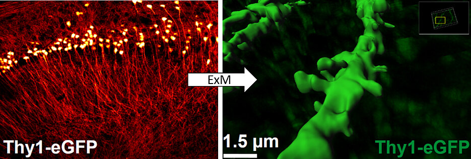 Superaufgelöste Bilder made in Würzburg: Mit der Expansionsmikroskopie ExM lassen sich Feinstrukturen des Gehirns präzise darstellen, deren Gestalt sich bei Lern- und Gedächtnisprozessen verändert. Zu sehen sind Pyramidenzellen aus dem Hippokampus der Mauslinie Thy1-eGFP.