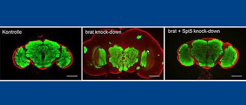 Gehirne von drei Tage alten erwachsenen Fliegen. Links: Gesunde Exemplare. In der Mitte Tiere mit einem Gehirntumor. Rechts: Gehirntumor nach Reduktion der SPT5-Menge. Die grüne Färbung zeigt zentrale Hirnregionen. Rot gefärbt ist die Hirnrinde, der sogenannt Kortex zu sehen, die vom Tumor stark gedehnt wird. 