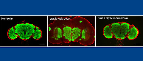 Brains of three-day-old adult flies. Left: Healthy specimens. Center: animals with a brain tumor. Right: Brain tumor after reduction of SPT5 levels. Green coloring shows central brain regions. Red coloring shows the cerebral cortex, which is strongly expanded by the tumor.