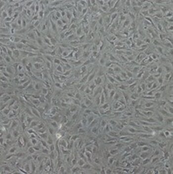 Endothelia cells derived from Hey1/2 deficient mouse embryonic stem cells after 14 days of differentiation