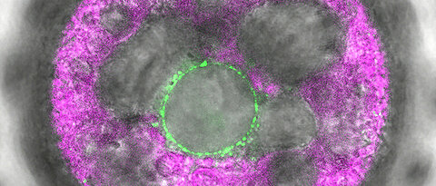 In dieser mehrzelligen Volvox-Alge wurde der neuartige Lichtsensor 2c-Cyclop mit Fluoreszenz grün markiert. Er zeigt sich in Membranen um den Zellkern herum.
