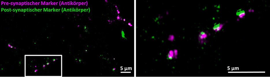 Synapsen von Gehirnzellen, mit konventioneller Fluoreszenzmarkierung auf Antikörperbasis sichtbar gemacht: Die Pre-Synapsen (rot) und die Post-Synapsen (grün) erscheinen leicht unscharf; der synaptische Spalt ist nicht vollständig aufgelöst. (Bild: Fr