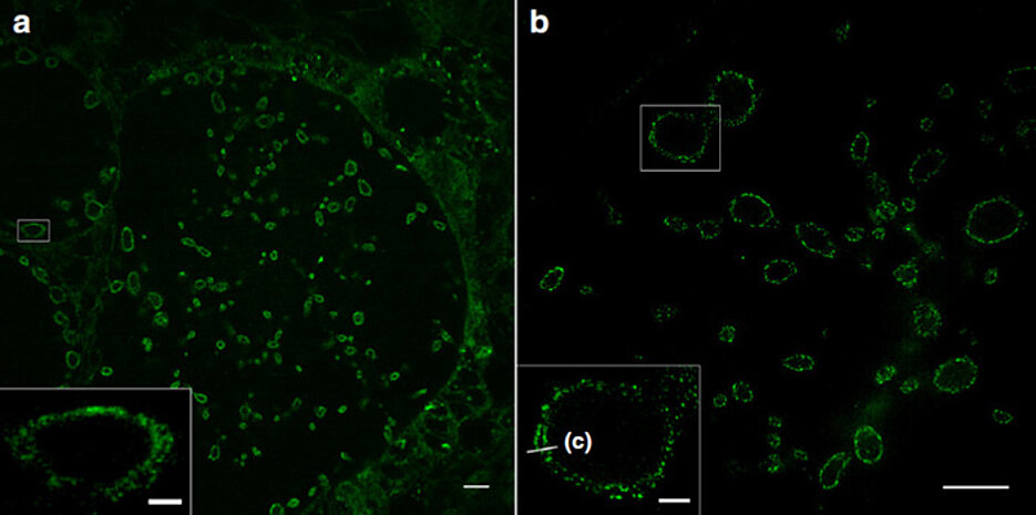 Sphingolipid-Expansionsmikroskopie (ExM) von zehnfach expandierten Zellen, die mit Chlamydien infiziert wurden. Grün markiert sind die Bakterienmembranen; die innere und die äußere Membran der Bakterien lassen sich unterscheiden (c). Unter (a) konfokales Laser-Scanning und unter (b) Strukturierte Beleuchtungsmikroskopie (SIM). Maßstabsbalken: 10 bzw. 2 Mikrometer in den kleinen weißen Rechtecken.