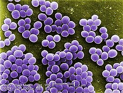 Staphylococcus aureus - Chair of Microbiology