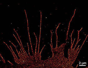 So gut aufgelöste Bilder liefert die Mikroskopietechnik dSTORM: Die Aufnahme zeigt in diesem Fall die Verteilung des beta-1-adrenergen Rezeptors auf der Membran einer Nierenzelle mit nahezu molekularer Auflösung. Die fädigen Strukturen sind Ausläufer 