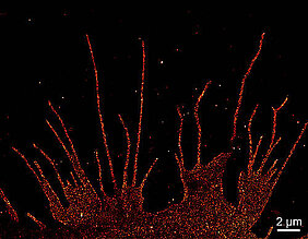 So gut aufgelöste Bilder liefert die Mikroskopietechnik dSTORM: Die Aufnahme zeigt in diesem Fall die Verteilung des beta-1-adrenergen Rezeptors auf der Membran einer Nierenzelle mit nahezu molekularer Auflösung. Die fädigen Strukturen sind Ausläufer der Zelle. (Bild: Teresa Klein) So gut aufgelöste Bilder liefert die Mikroskopietechnik dSTORM: Die Aufnahme zeigt in diesem Fall die Verteilung des beta-1-adrenergen Rezeptors auf der Membran einer Nierenzelle mit nahezu molekularer Auflösung. Die fädigen Strukturen sind Ausläufer