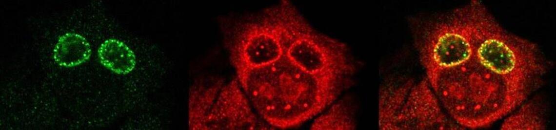 HEK-293T cells infected with Chlamydia trachomatis expressing chlamydial deubiquitinase Cdu1-FLAG