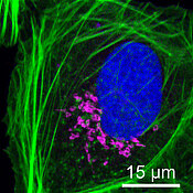 Das Verfahren sFLIM ermöglicht es, selbst kleinste Unterschiede im Fluoreszenzverhalten der Farbstoffe für deren eindeutige Identifizierung auszunutzen. So können drei verschiedene Zellstrukturen gleichzeitig mit demselben Fluoreszenzfarbstoff markiert