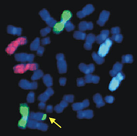 Wenn es im Körper zu wenige RAD50-Proteine gibt, treten typische Veränderungen an den Chromosomen auf: Die Träger der Erbanlagen brechen auseinander oder tauschen untereinander Bruchstücke aus. Letzteres ist auf dem Bild zu sehen. Das mit dem Pfeil ma