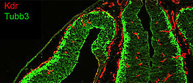 Distribution of endothelial cells (red) and neuronal cells (green) in the brain of adult mice.