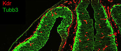 Distribution of endothelial cells (red) and neuronal cells (green) in the brain of adult mice.