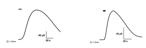 and 2 conductivity traces of an oocyte in which a cAMP-sensitive anion channel (CFTR) 