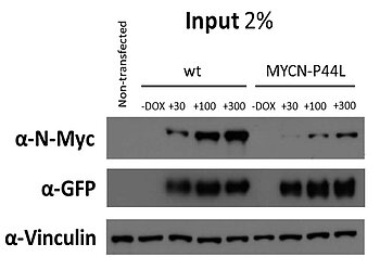 Immunpräzipitation (IP) mit Ganzzellextrakten von HEK293TD Zellen, die mit Sleeping Beauty Expressionvektoren, die das Wild-type oder P44L-Mutant N-Myc und GFP (als Reportergen) enthalten, transfiziert wurden.