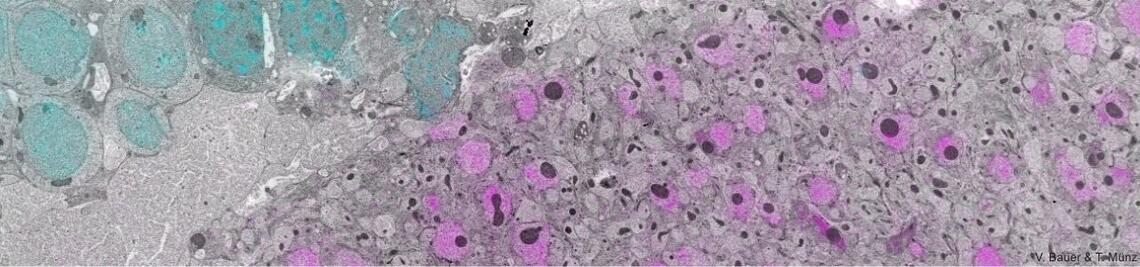 Correlativ light- and electron-microscopic image of mushroom body calyx tissue