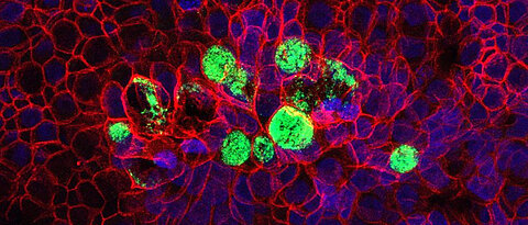 Mit Hilfe von Gewebemodelle lassen sich die angeborene sowie die erworbene Immunität erforschen. Hier zu sehen ist ein mit Bakterien (grün) infiziertes Gewebemodell von humanen Eileiterzellen.
