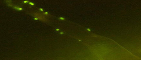 Wurzelhaar einer Pflanze mit angreifenden Bakterien (grün). Foto: Julius-von-Sachs-Institut für Biowissenschaften