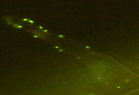 Wurzelhaar einer Pflanze mit angreifenden Bakterien (grün). Foto: Julius-von-Sachs-Institut für Biowissenschaften