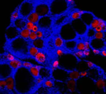 Fluorescent in situ hybridization in medaka ovary