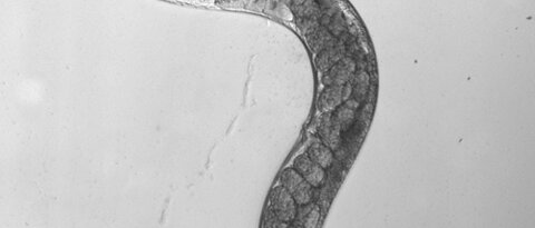 Schwarz-weiß-Foto eines Fadenwurms. Bild: A. Gottschalk, Uni Frankfurt