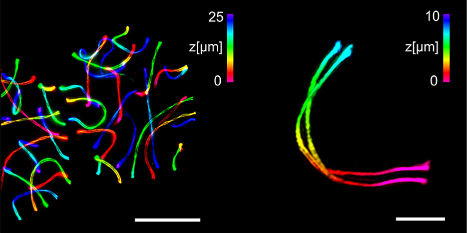 Links zwei spermienbildende Zellen, die mit ExM-SIM expandiert und mit einem beugungsbegrenzten Mikroskop abgebildet wurden. Rechts die detaillierte 3D-Aufnahme eines einzelnen synaptonemalen Komplexes. Die 3D-Information ist farblich kodiert, der Messbalken links entspricht 25 Mikrometer, der rechts drei Mikrometer.