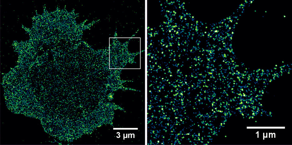 Die Abbildung zeigt die Verteilung von CD19-Antigenen in der Plasmamembran einer multiplen Myelomzelle aufgenommen mittels dSTORM.