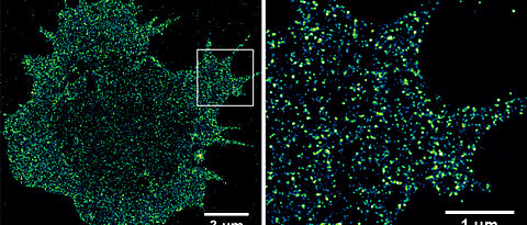 Die Abbildung zeigt die Verteilung von CD19-Antigenen in der Plasmamembran einer multiplen Myelomzelle aufgenommen mittels dSTORM.