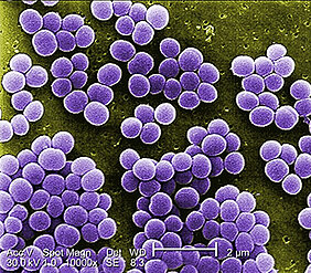 Rasterelektronenmikroskopische Aufnahme von S.aureus (Foto: Janice Haney, Centers for Disease Control and Prevention)